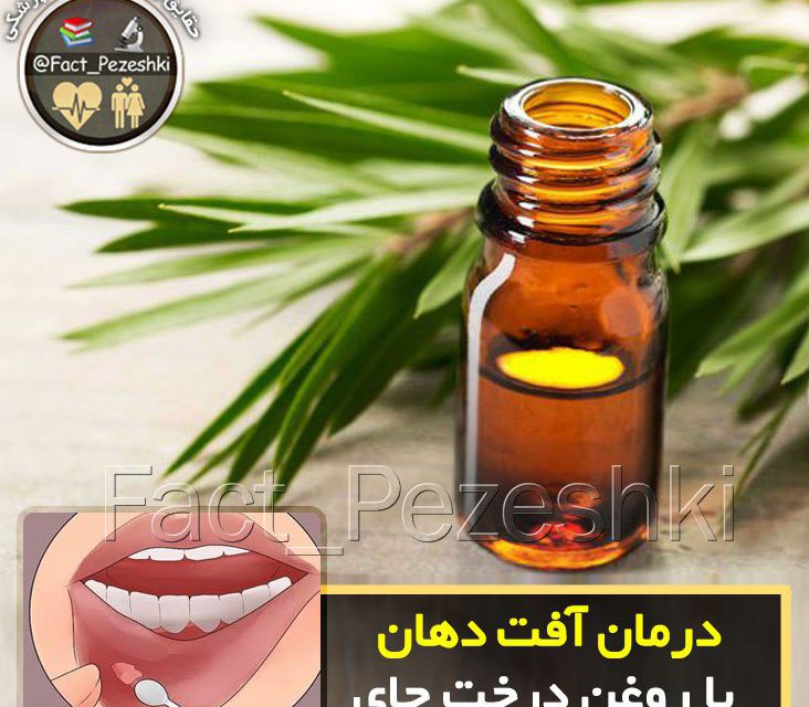 ‍ درمان آفت دهان