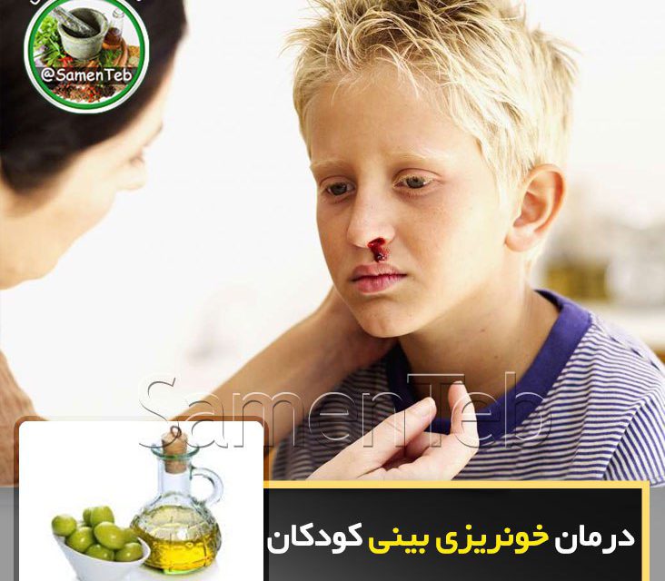 ️درمان خونریزی بینی کودکان