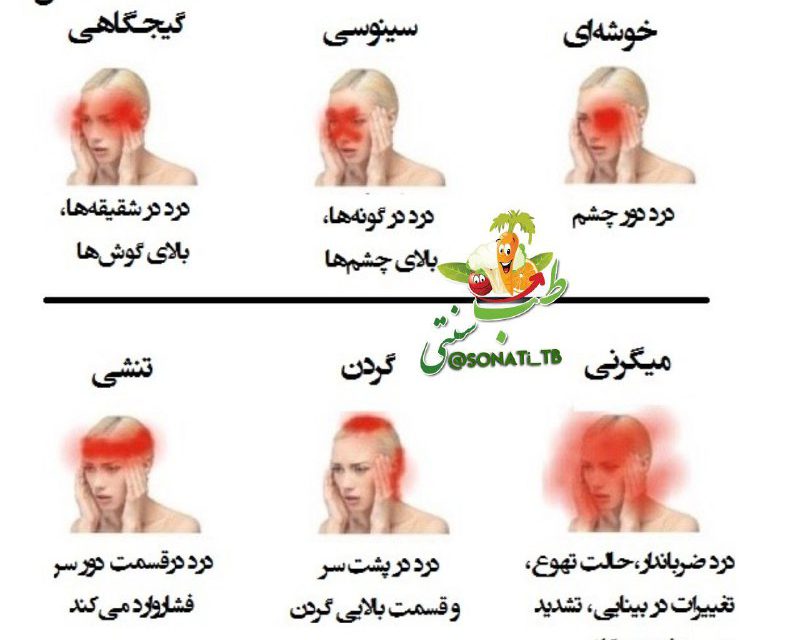 درمان انواع سردرد