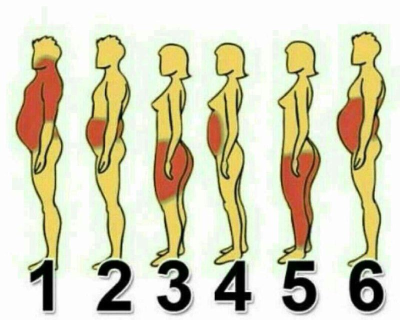 چاقی شما ازکدام نوع می باشد؟