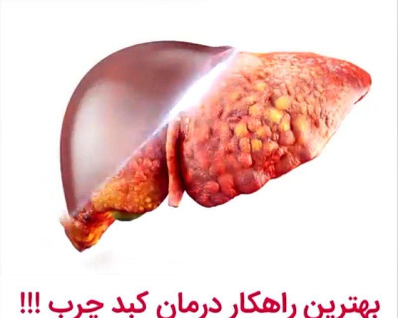 بهترین راهکار برای مبتلا نشدن