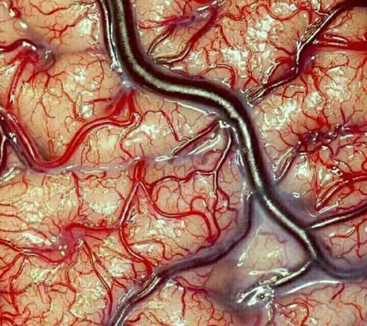 تصویری شگفت انگیز از مغز گرفته شده توسط یک متخصص مغز و اعصاب آمریکایی